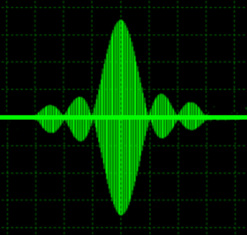 MR radiofrequency (RF) pulse; sync pulse