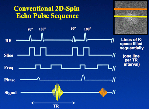 spin-warp imaging (2D spin echo)