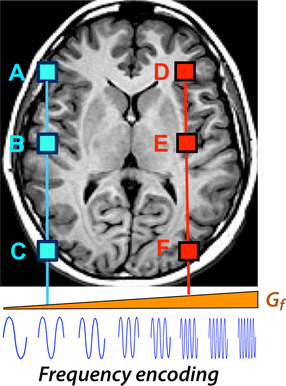 frequency encoding MRI