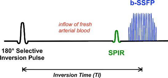 inflow-enhanced SSFP MRA 