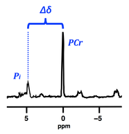 pH estimation by 31P MRS