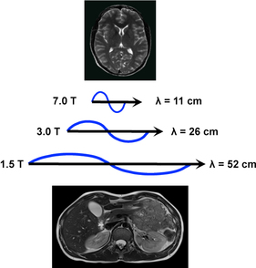 RF wavelengths in body