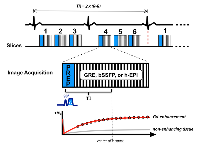 saturation recovery myocardial perfusion