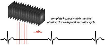 cardiac MRI and k-space