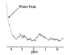 incomplete water suppression MRS