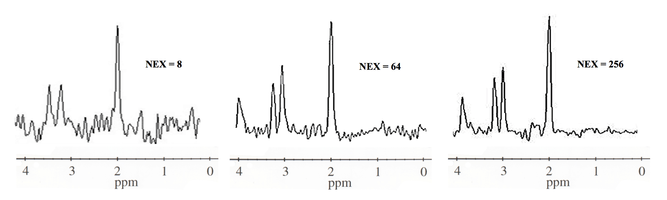 MR spectroscopy