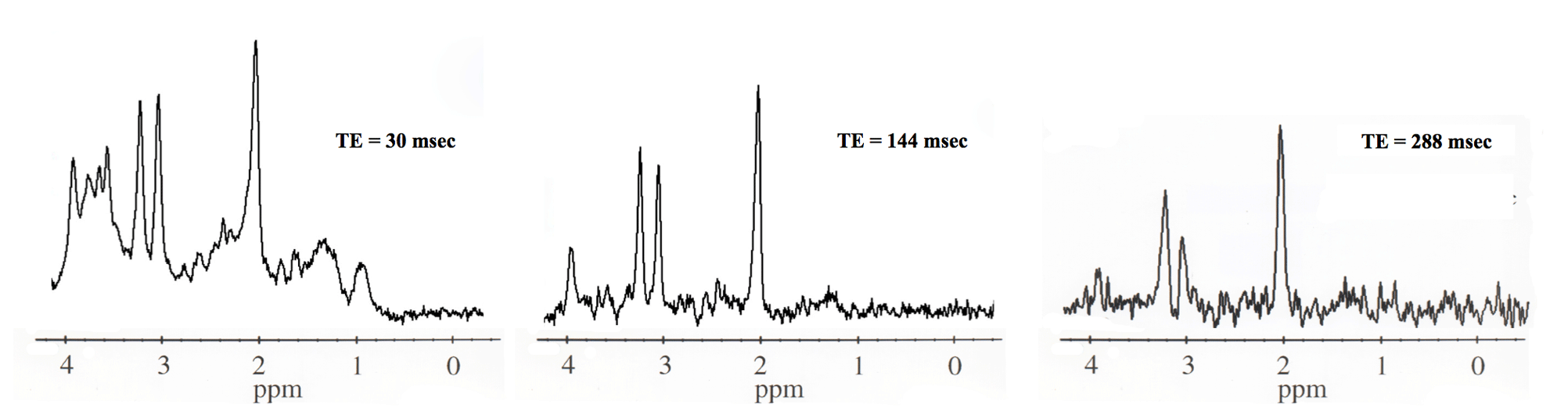 MR Spectroscopy