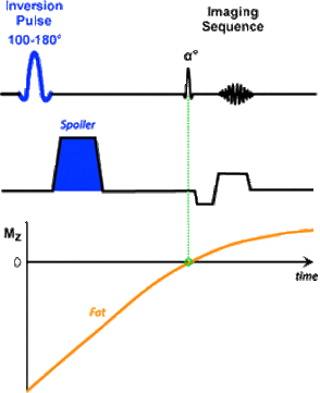 Spectral Presaturation with Inversion Recovery (SPIR)