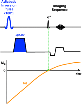 SPAIR (SPectral Attenuated Inversion Recovery)