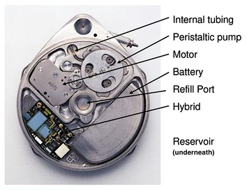 SynchroMed II