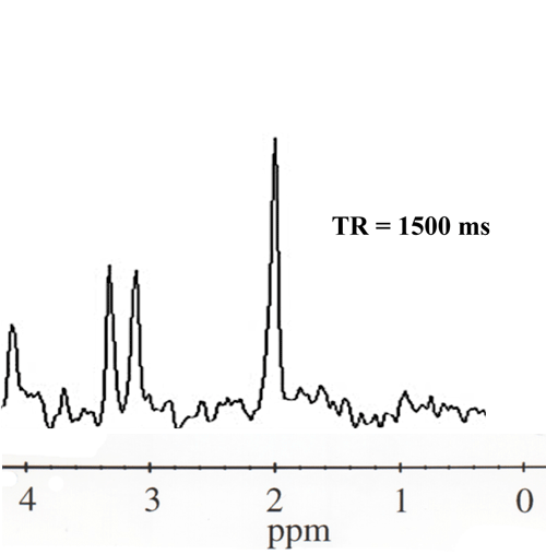 MR spectroscopy